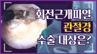 회전근개파열, 관절경 수술을 꼭 해야 할까?