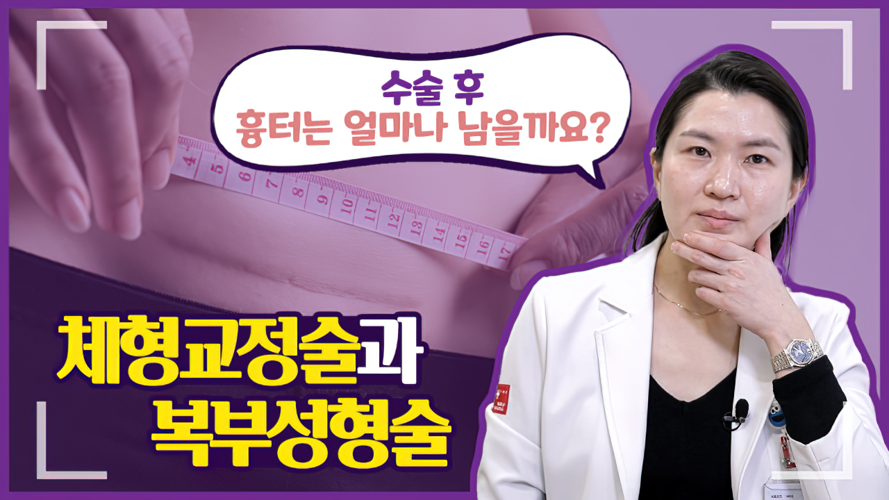 비만수술 후 체형교정술이란?